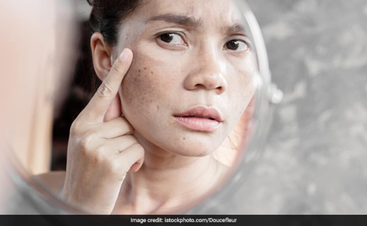 5 Secrets to Flawless Skin from a Top Pigmentation Clinic in Singapore