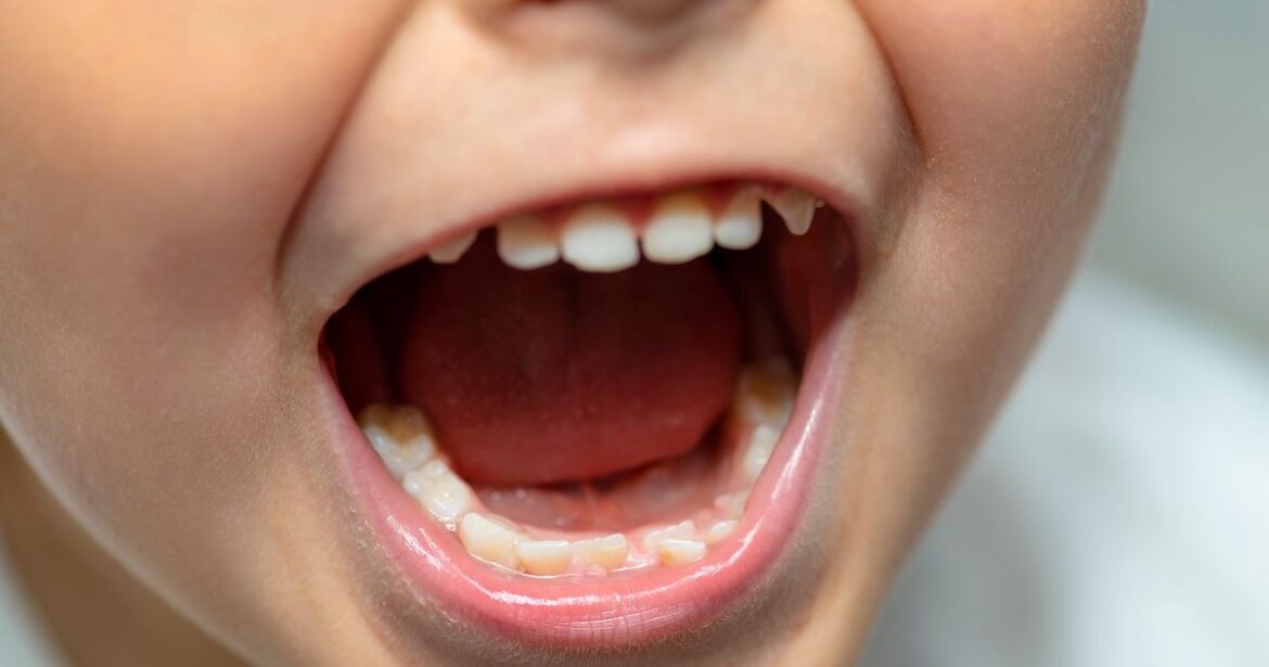 Kids Teeth Cycle: Eruption and Loss